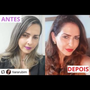 Antes e Depois